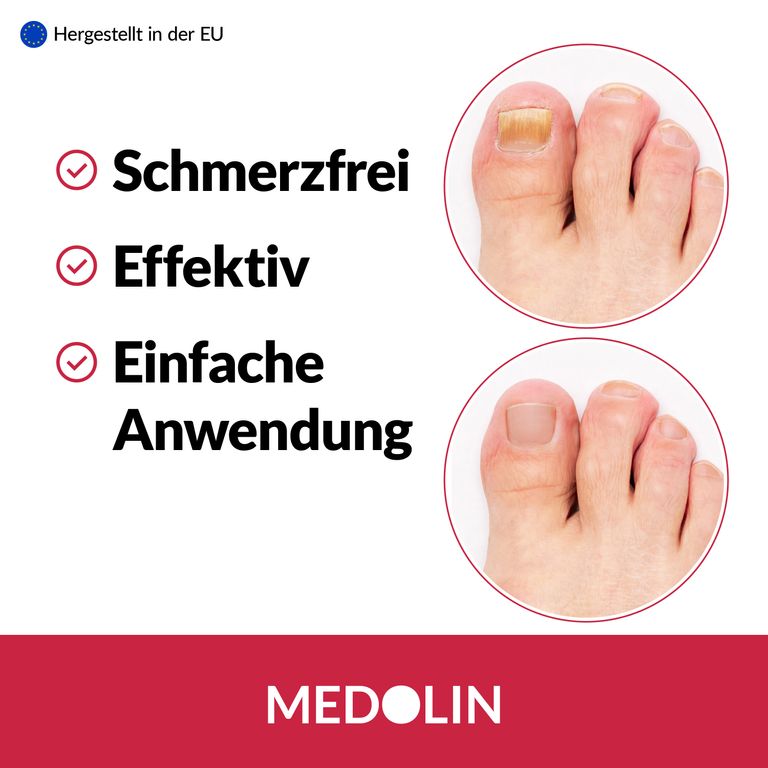 Shopapotheke Medolin® Nagelpilz Lösung 3er Set