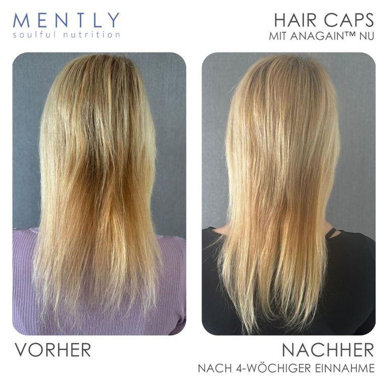 Shopapotheke MENTLY Hair Caps