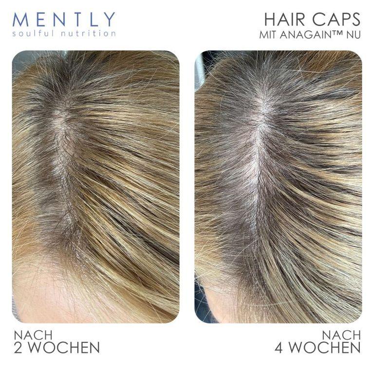Shopapotheke MENTLY Hair Caps
