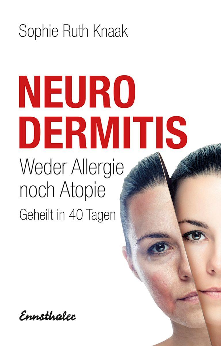 shopapotheke Neurodermitis