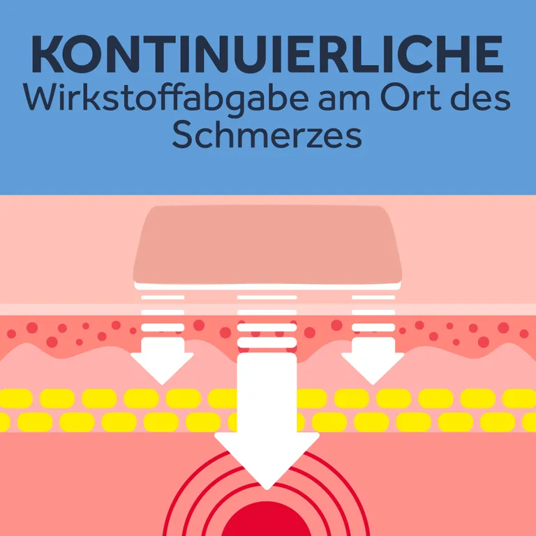 Shopapotheke NUROFEN® 24-Stunden Schmerzpflaster