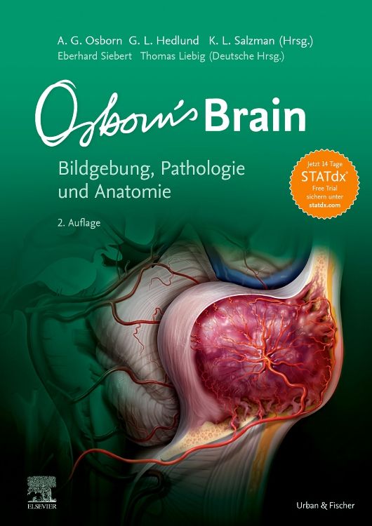 shopapotheke Osborn's Brain