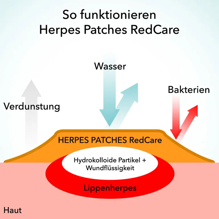 Shopapotheke Redcare Herpes Patches