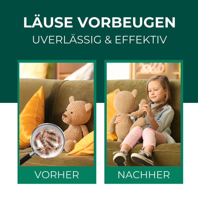 Shopapotheke SILBEKRAFT Läusespray