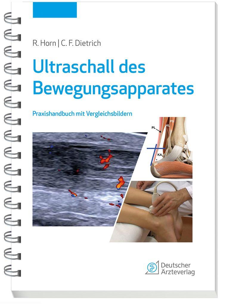 shopapotheke Ultraschall des Bewegungsapparates