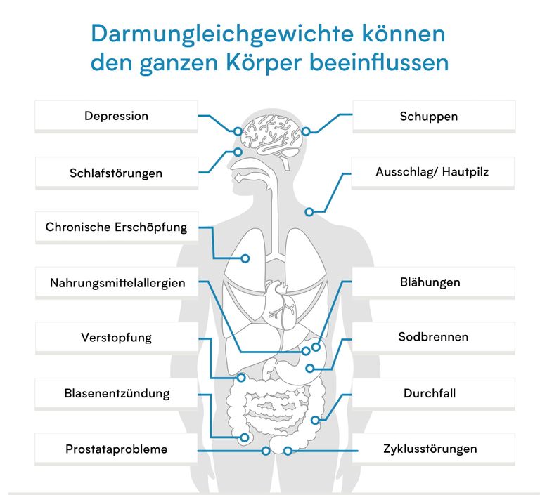 Shopapotheke Verisana Parasiten Komplett Check