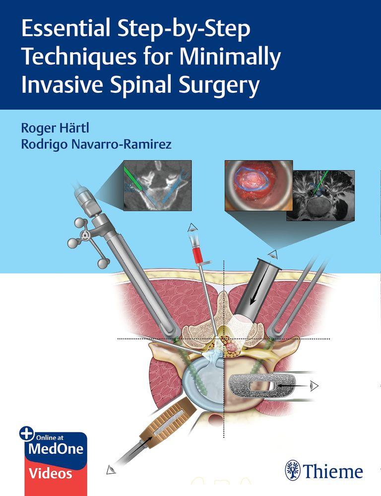 shopapotheke Ten Step Techniques for Minimally Invasive Spine Surgery