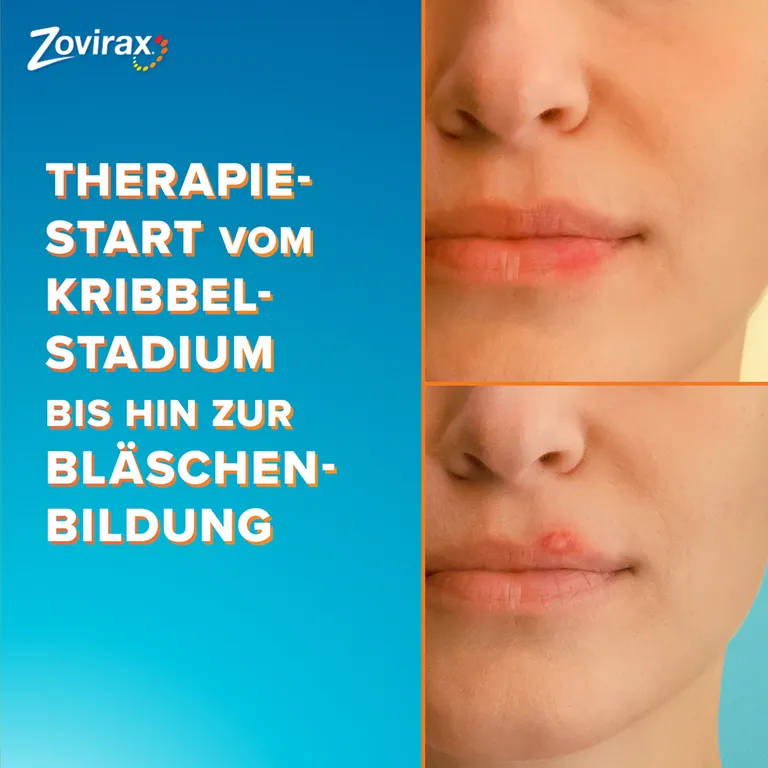 Shopapotheke Zovirax Lippenherpescreme. 5 % Aciclovir. 2 G Packung