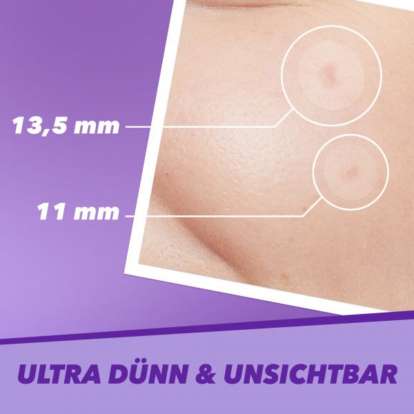 Bodyguardapotheke BENZACARE Power Patch Gegen Pickel