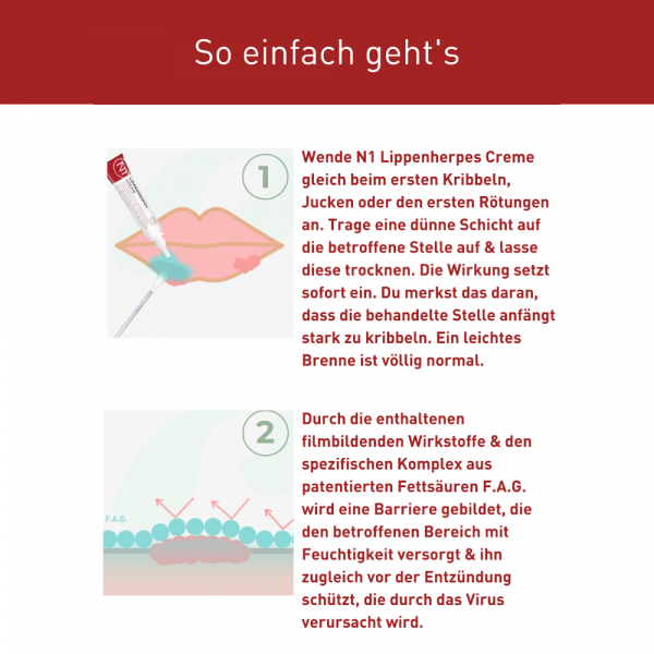 Bodyguardapotheke N1 LIPPENHERPES Creme