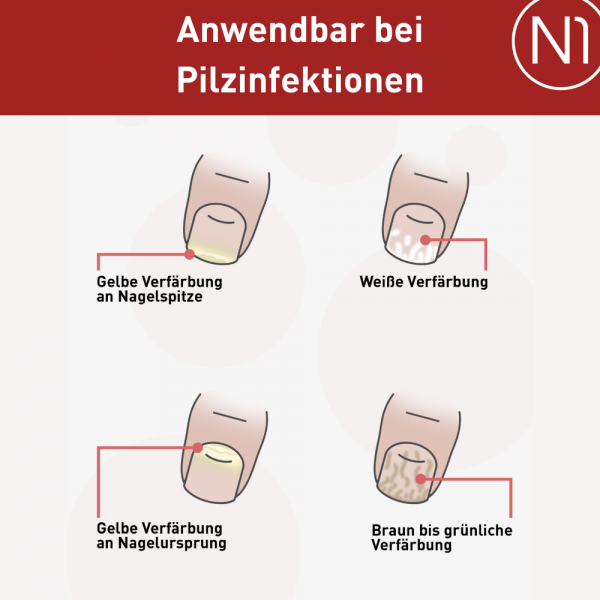 Bodyguardapotheke N1 Nagelpilz Lösung