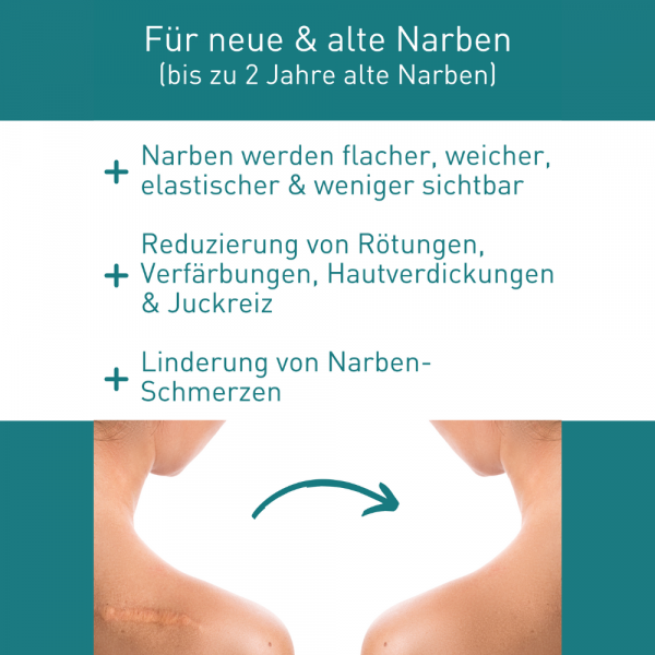 Bodyguardapotheke N1 Narben Gel