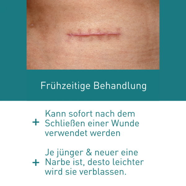 Bodyguardapotheke N1 Narben Gel