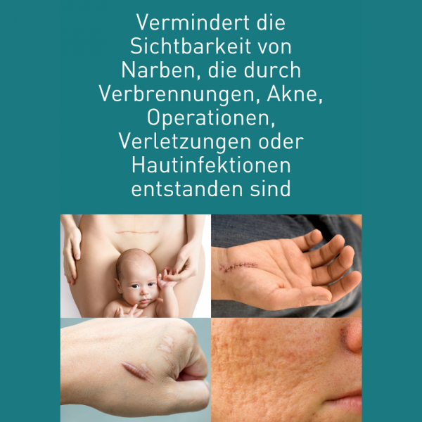 Bodyguardapotheke N1 Narben Gel