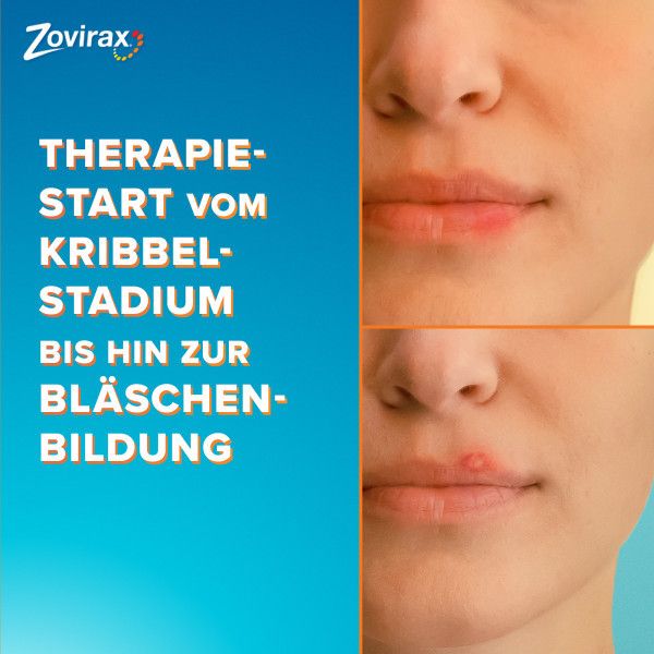 Bodyguardapotheke ZOVIRAX Lippenherpes Creme