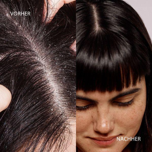 Bodyguardapotheke DUCRAY KELUAL DS Anti-Schuppen-Shampoo