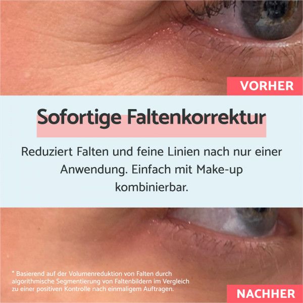 Bodyguardapotheke Remescar Anti-Falten-Creme Mit Soforteffekt 8ml
