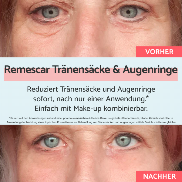 Bodyguardapotheke Remescar Tränensäcke & Dunkle Augenringe 8ml