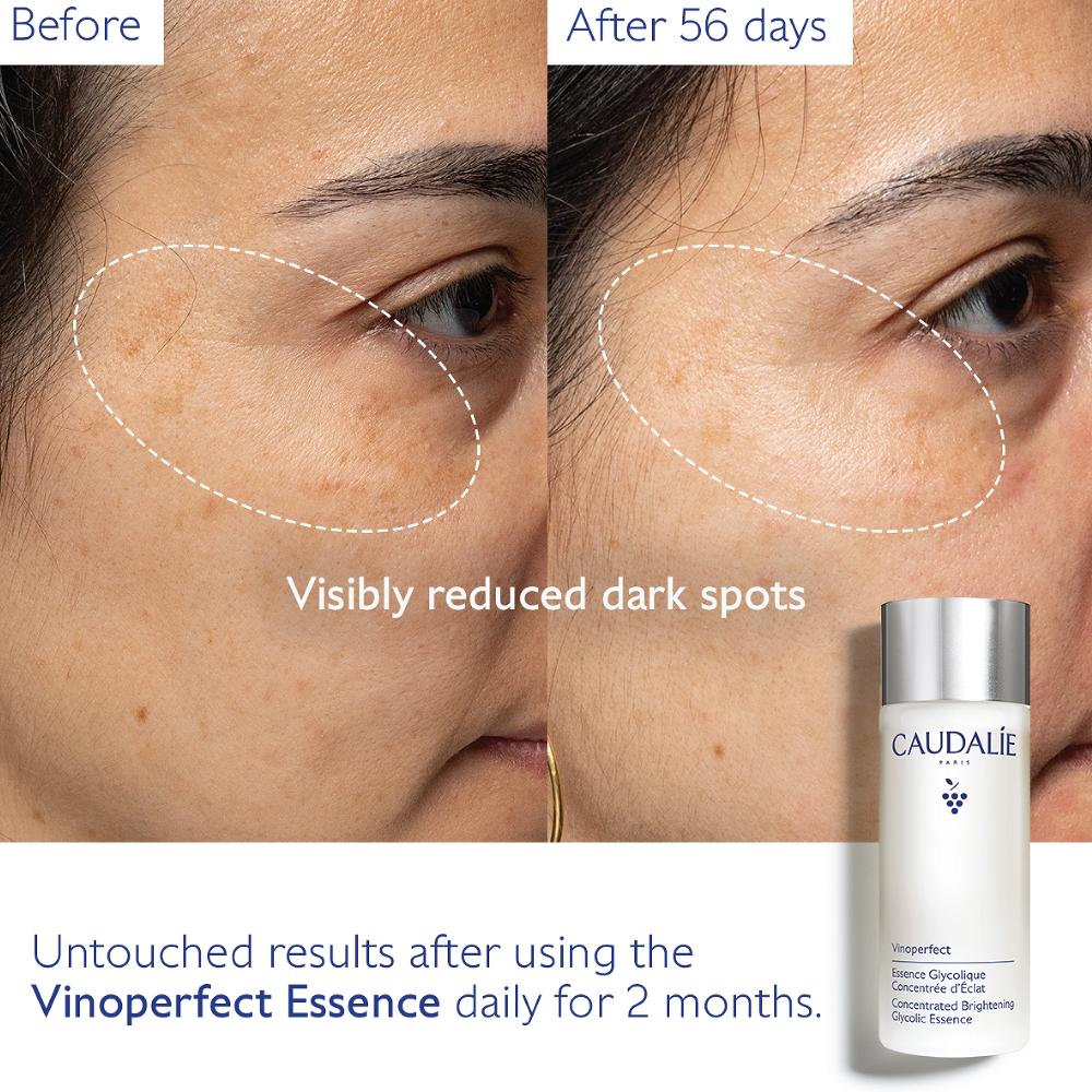 Lookfantastic Caudalie Vinoperfect Concentrated Glycolic Essence 100ml