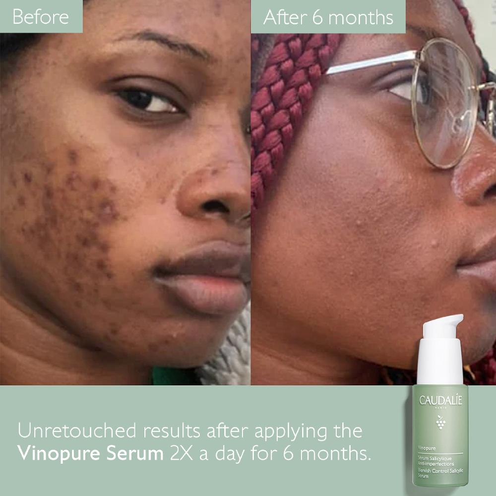 Lookfantastic Caudalie Vinopure Blemish Control Salizyl-Serum 30ml