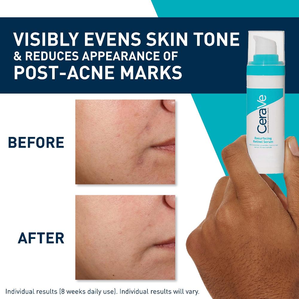 Lookfantastic CeraVe Resurfacing Retinol Serum With Ceramides And Niacinamide For Blemish-Prone Skin 30ml