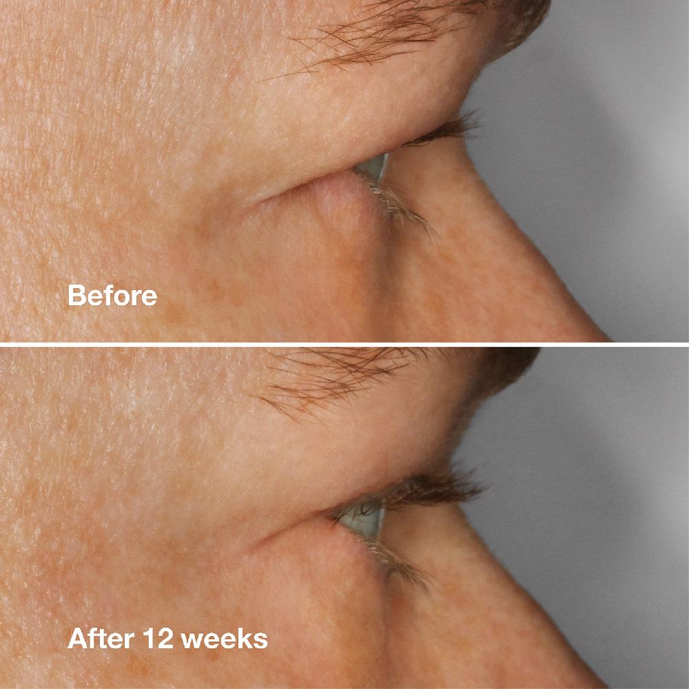 Lookfantastic Clinique High Impact Lash Amplifying Serum