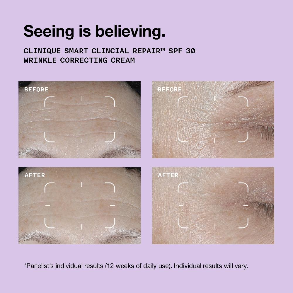 Lookfantastic Clinique Smart Clinical Repair SPF 30 Wrinkle Correcting Cream 50ml