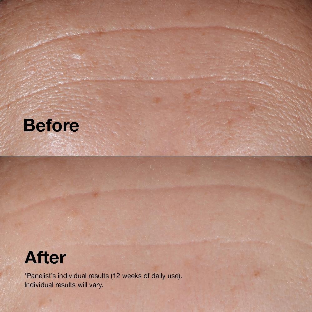 Lookfantastic Clinique Smart Clinical Repair Wrinkle Correcting Serum 30ml