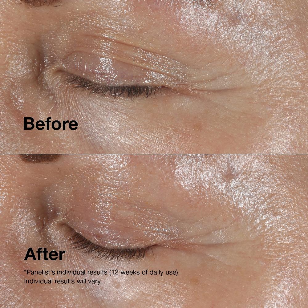 Lookfantastic Clinique Smart Clinical Repair Wrinkle Correcting Eye Cream 15ml