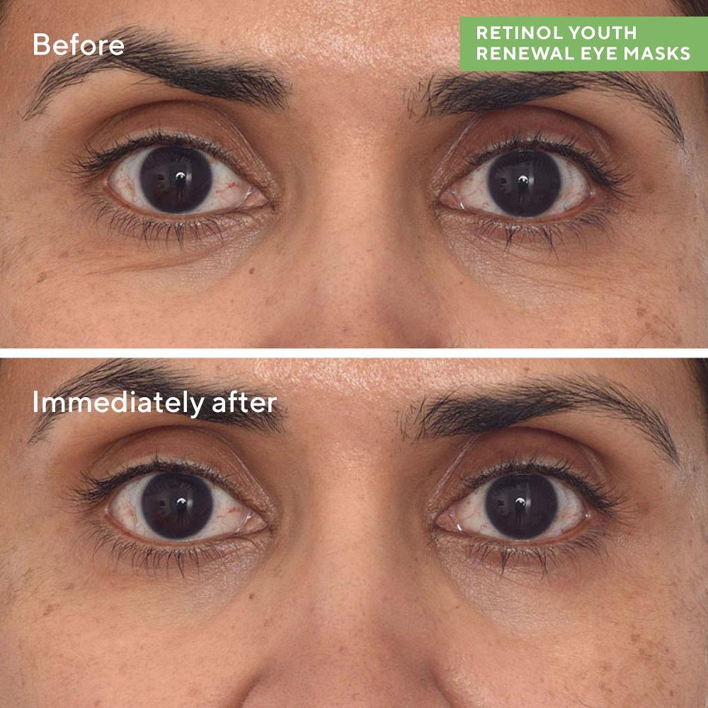 Lookfantastic Dr. Zion X Murad Retinol Youth Renewal Augenmasken (5er-Pack)