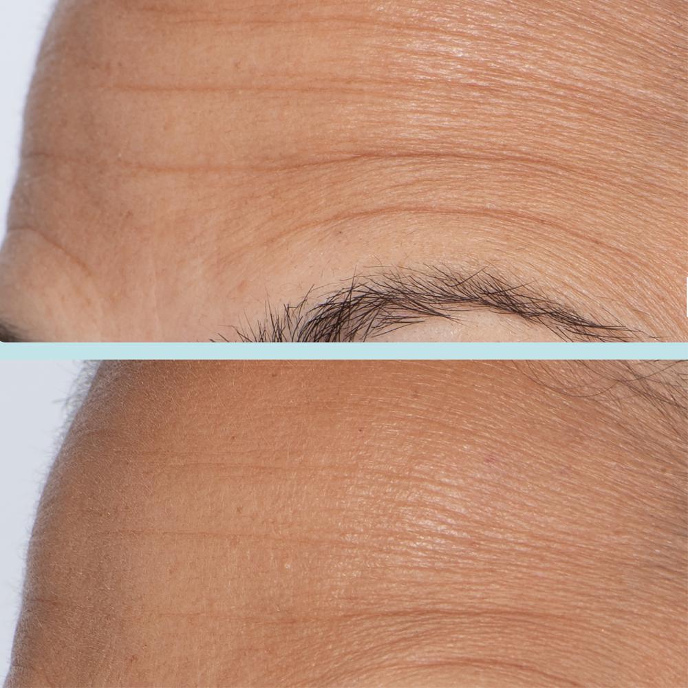 Lookfantastic First Aid Beauty Sprungkraftverstärkendes Serum Mit Kollagen + Peptiden 30 ml