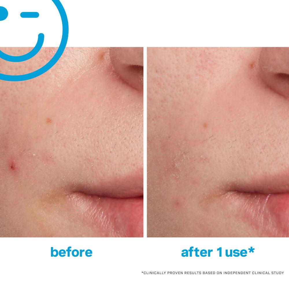 Lookfantastic Kate Somerville EradiKate Behandlung Gegen Unreinheiten 30 ml
