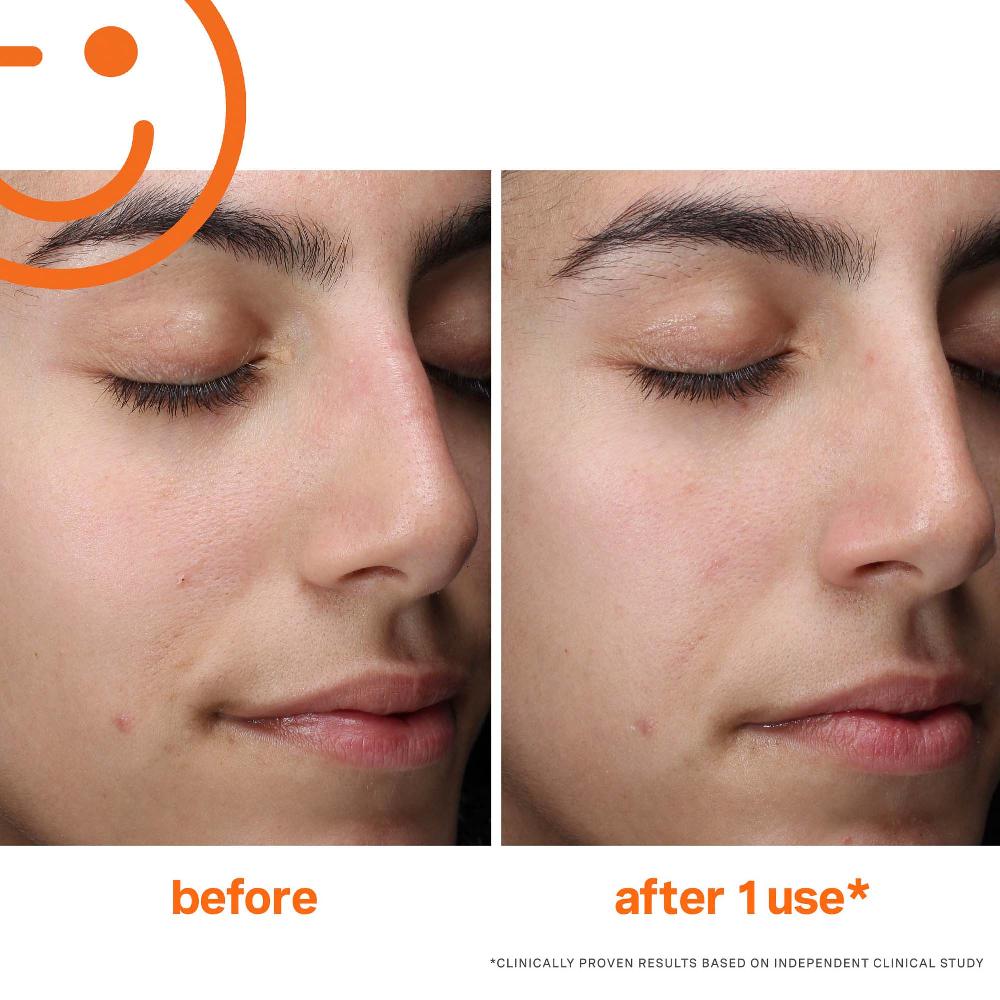 Lookfantastic Kate Somerville ExfoliKate Schäumende Gesichtsreinigung Für Den Täglichen Gebrauch 120 ml