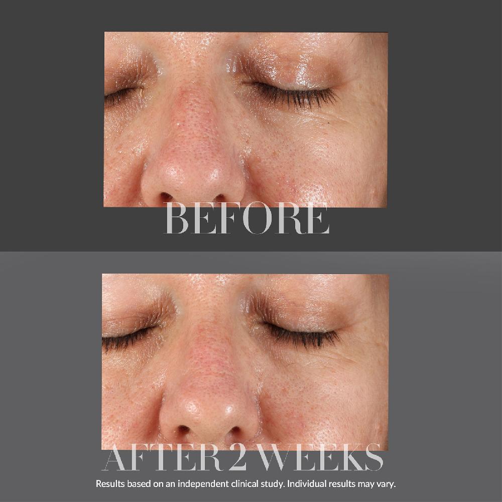 Lookfantastic Kate Somerville KateCeuticals Resurfacing Overnight Peel 30ml
