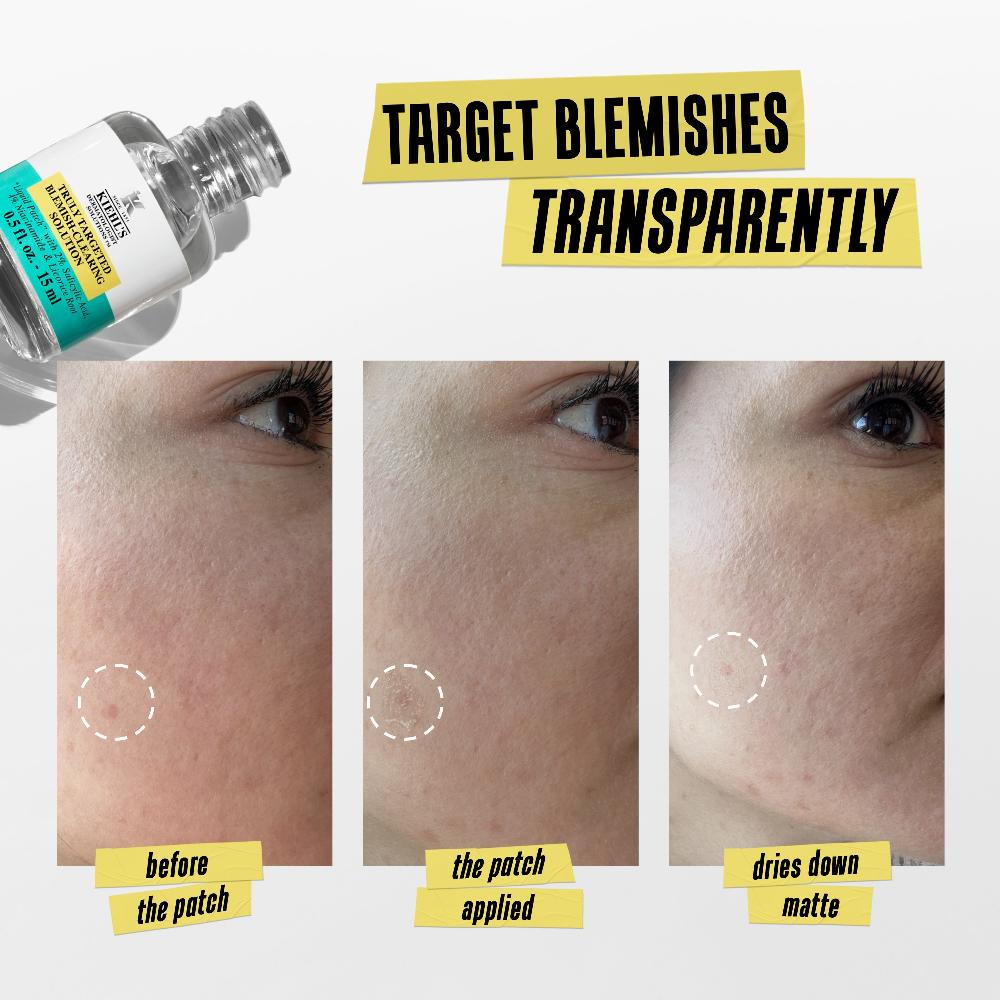 Lookfantastic Kiehl's Truly Targeted Blemish-Clearing Solution 15ml