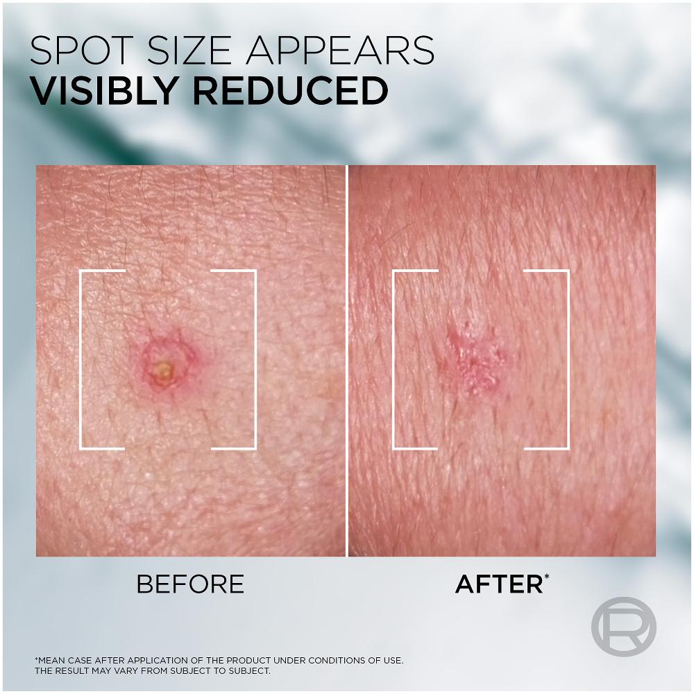 Lookfantastic L'Oréal Men Expert Derma Control S.O.S Pimple Paste With 5% Niacinamide + Glycolic Acid 45ml