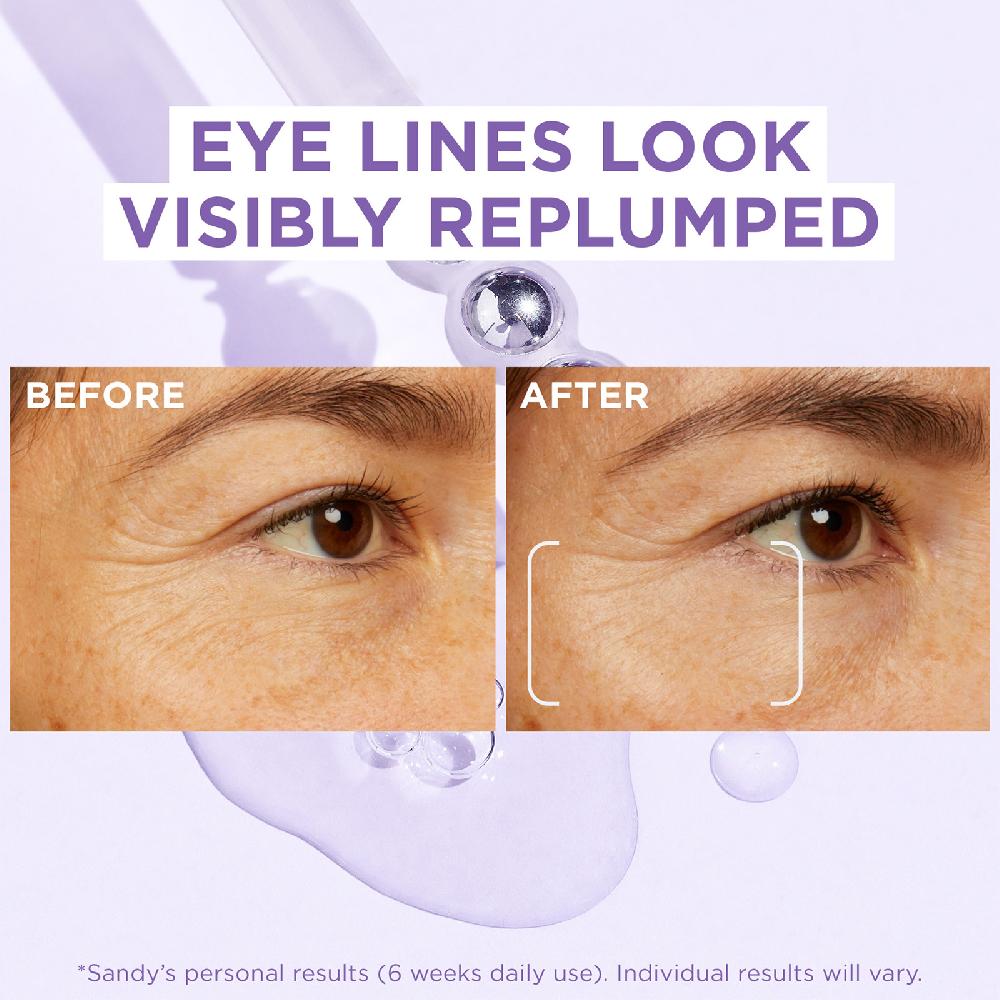 Lookfantastic L'Oréal Paris 2 5 % Hyaluronsäure-Augenserum 20 ml