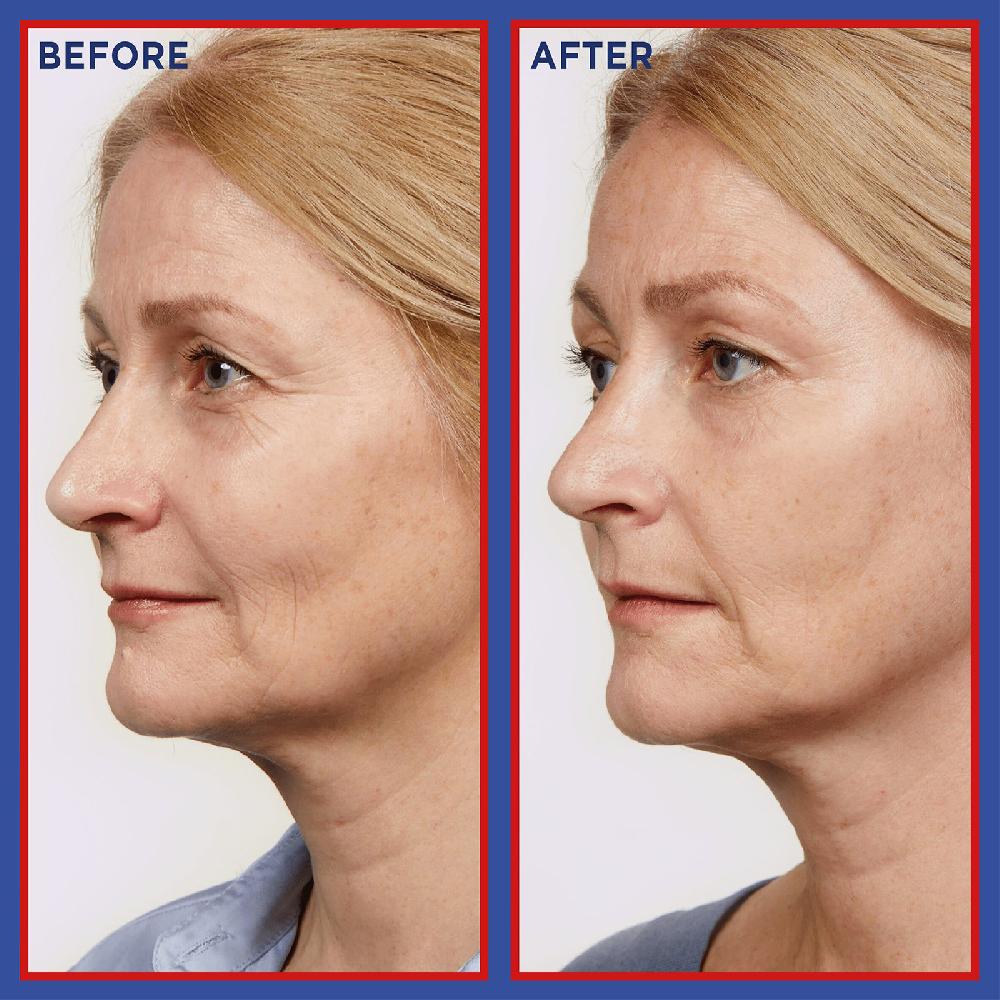 Lookfantastic L'Oréal Paris Pure Retinol Revitalift Laser Nachtserum 30 ml