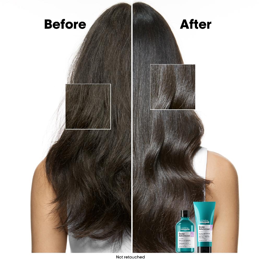Lookfantastic L’Oréal Professionnel Scalp Advanced Anti-Discomfort Shampoo 300ml And Refill Pack 500ml Deep Scalp Treatment
