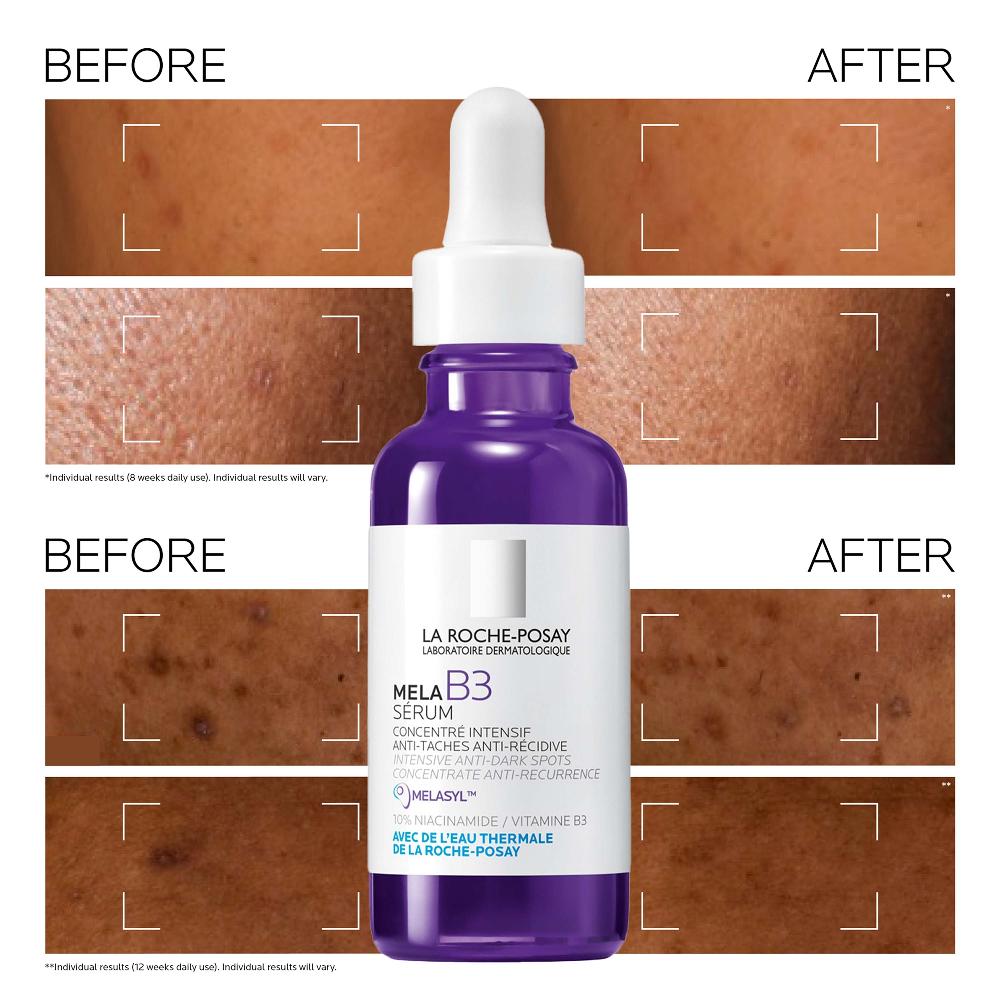 Lookfantastic La Roche-Posay MelaB3 Serum: Intensives Serum Gegen Dunkle Flecken Für Hyperpigmentation 30 ml