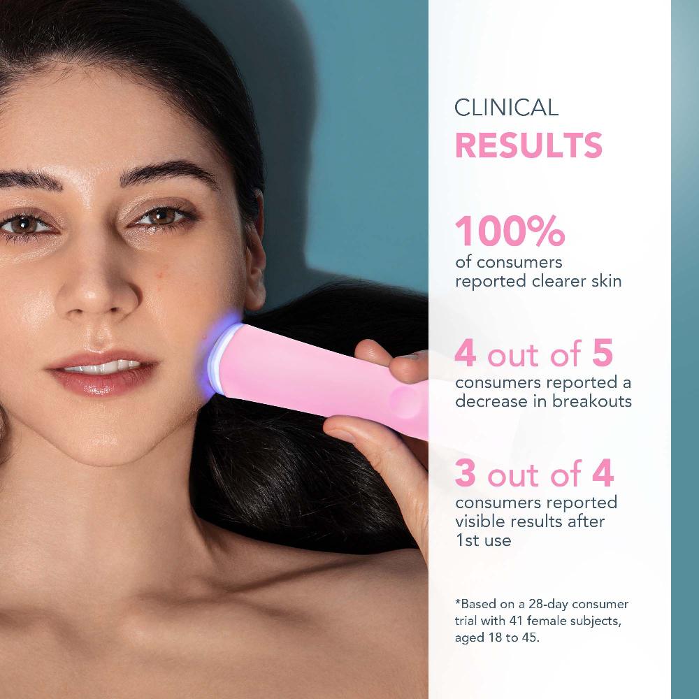 Lookfantastic FOREO ESPADA 2-Gerät – Perlrosa