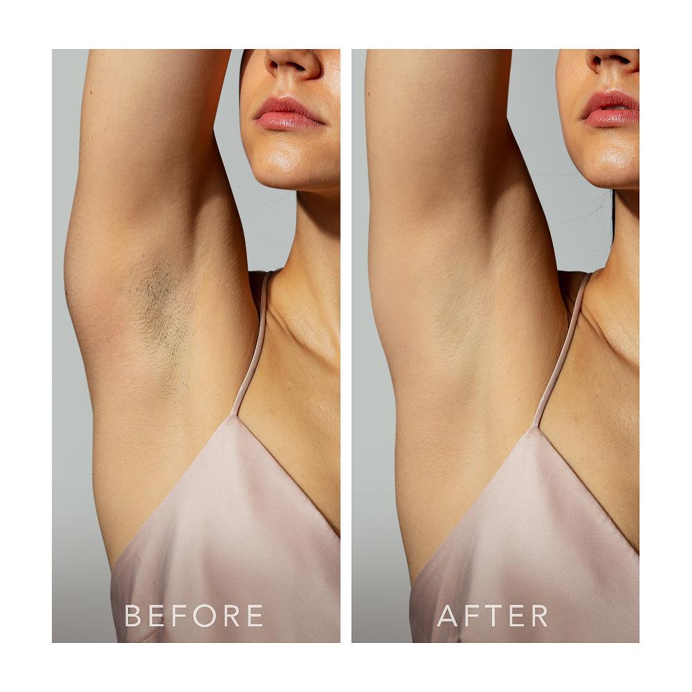 Lookfantastic FOREO PEACH 2 Minze