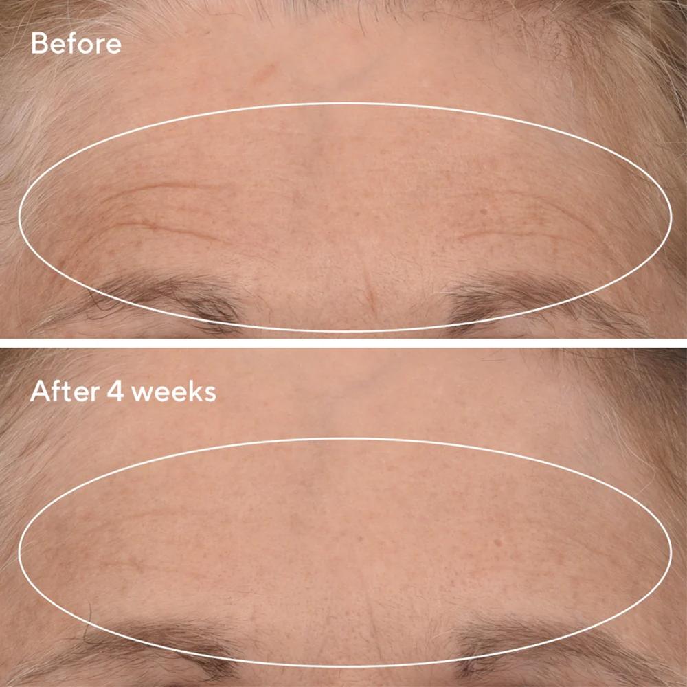 Lookfantastic Murad All About Retinal Set