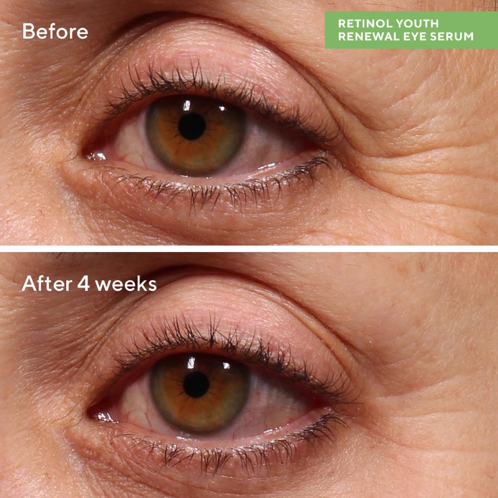 Lookfantastic Murad Rapid Wrinkle Repair Set