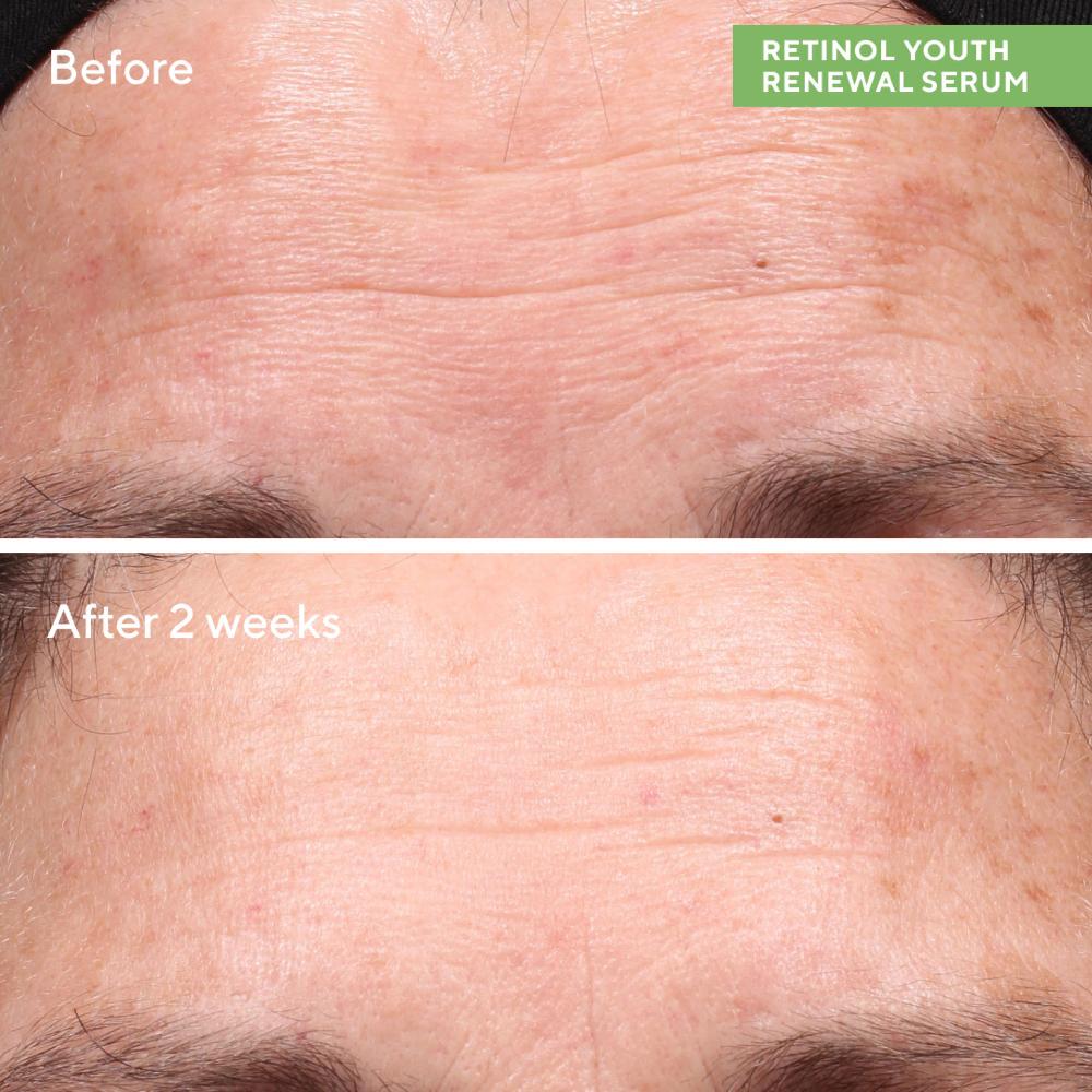 Lookfantastic Murad Retinol Revival Set
