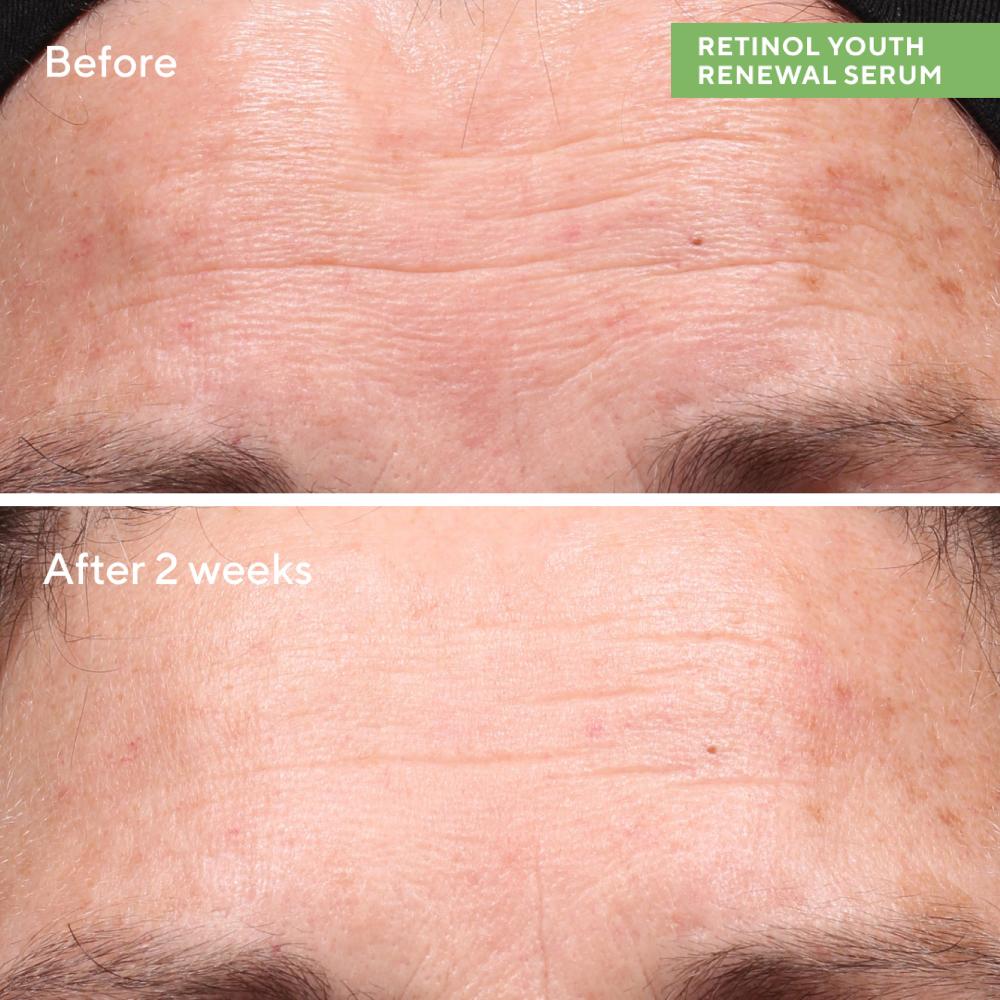 Lookfantastic Murad Retinol Starterkit