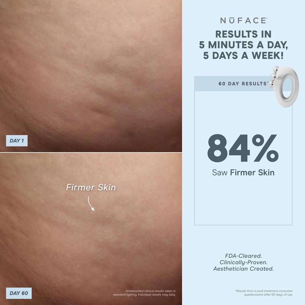 Lookfantastic NuBODY By NuFACE