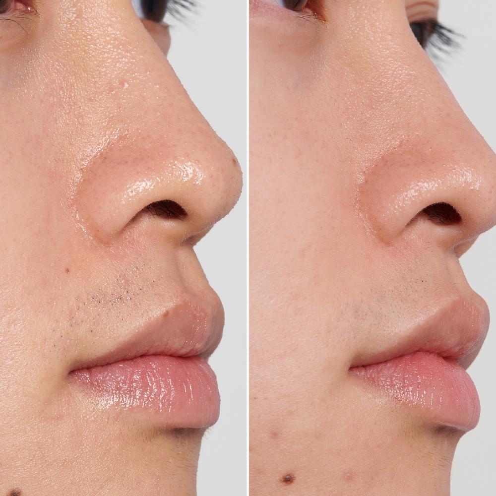 Lookfantastic The Inkey List PHA Toner