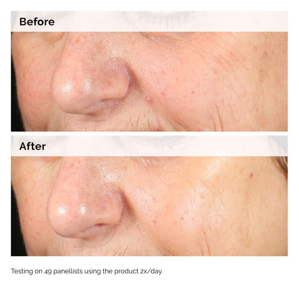Lookfantastic The Ordinary Alpha Arbutin 2% + HA 60ml
