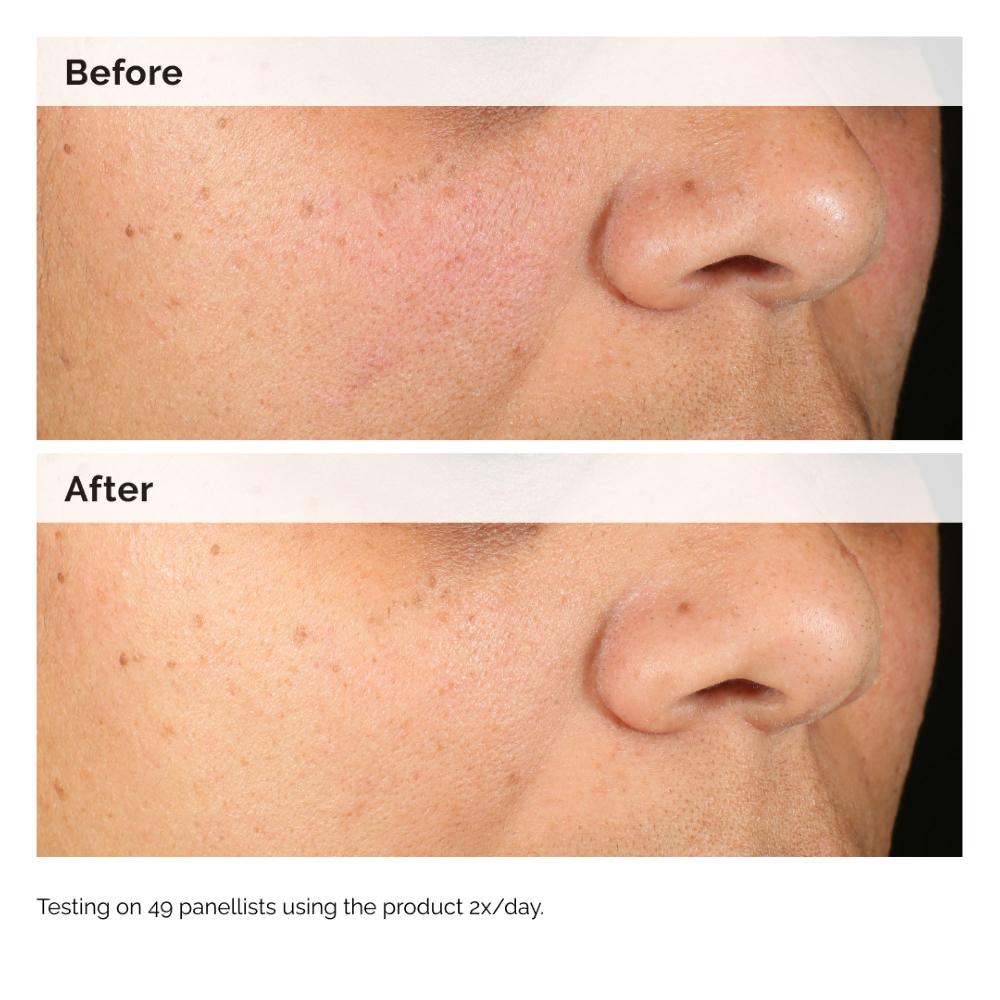 Lookfantastic The Ordinary Alpha Arbutin 2% + HA 60ml